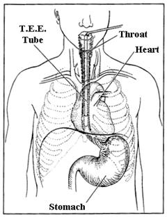Diagram showing the position of the T.E.E. relative to the throat, heart, and stomach